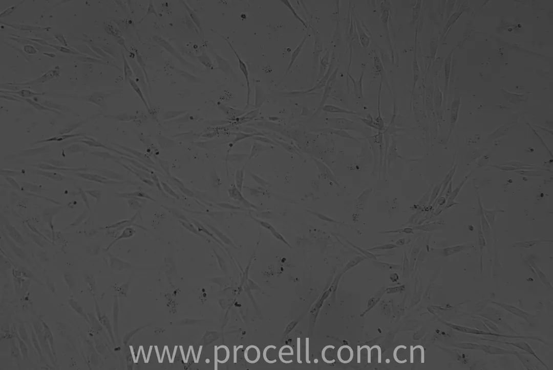 第1代人軟骨細(xì)胞狀態(tài)圖 第1代人軟骨細(xì)胞狀態(tài)圖