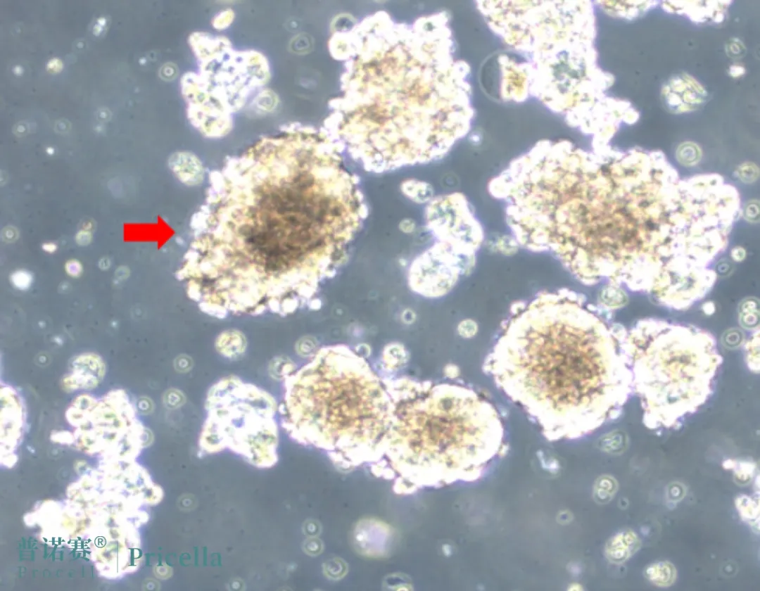 AtT-20細胞聚大團生長 AtT-20細胞聚大團生長