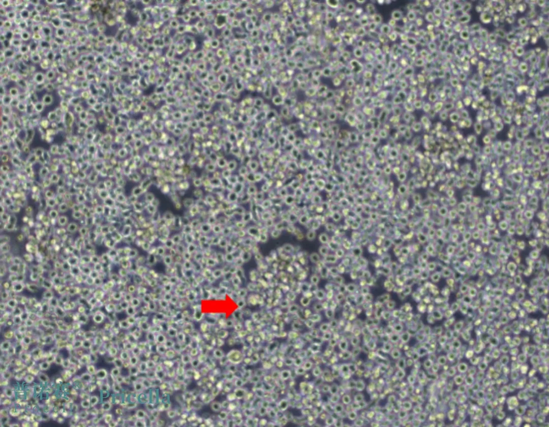 U2932細胞聚小團生長 U2932細胞聚小團生長