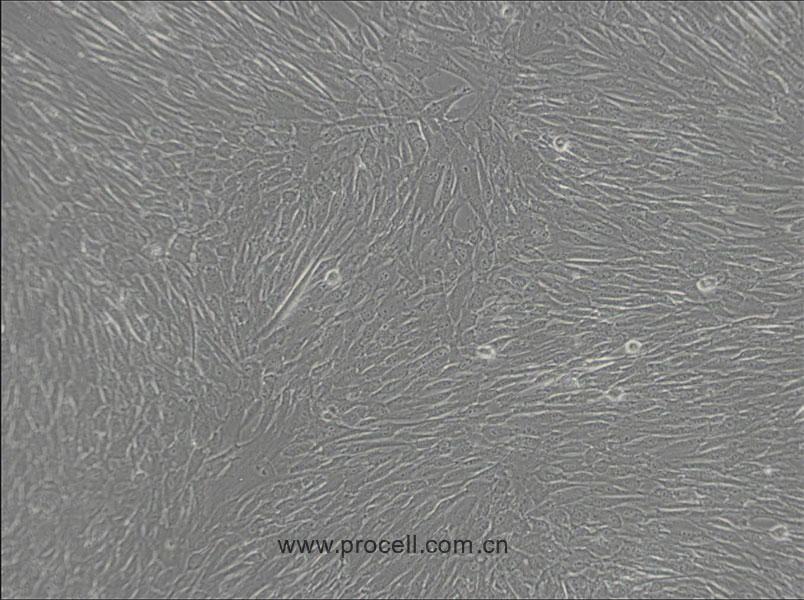 人間充質(zhì)干細(xì)胞無血清培養(yǎng)基