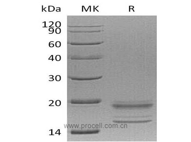 IL-17A/ F (C-6His), Human, Recombinant