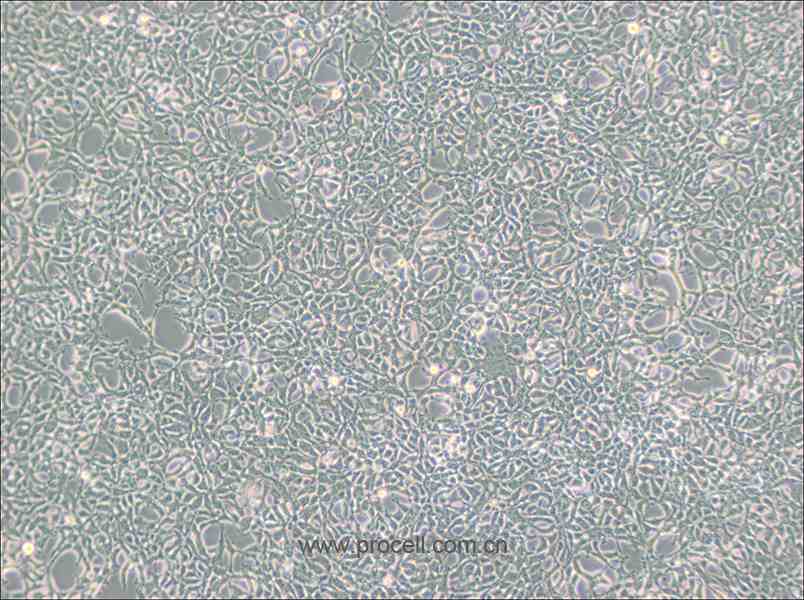 293 [HEK-293] (人胚腎細(xì)胞) (STR鑒定正確)