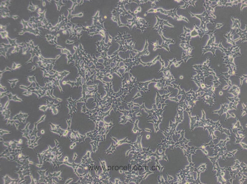 293T [HEK-293T](人胚腎細(xì)胞) (STR鑒定正確)
