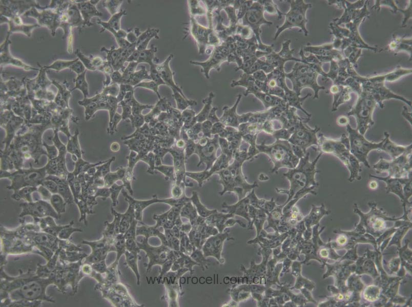 293T [HEK-293T](人胚腎細(xì)胞) (STR鑒定正確)