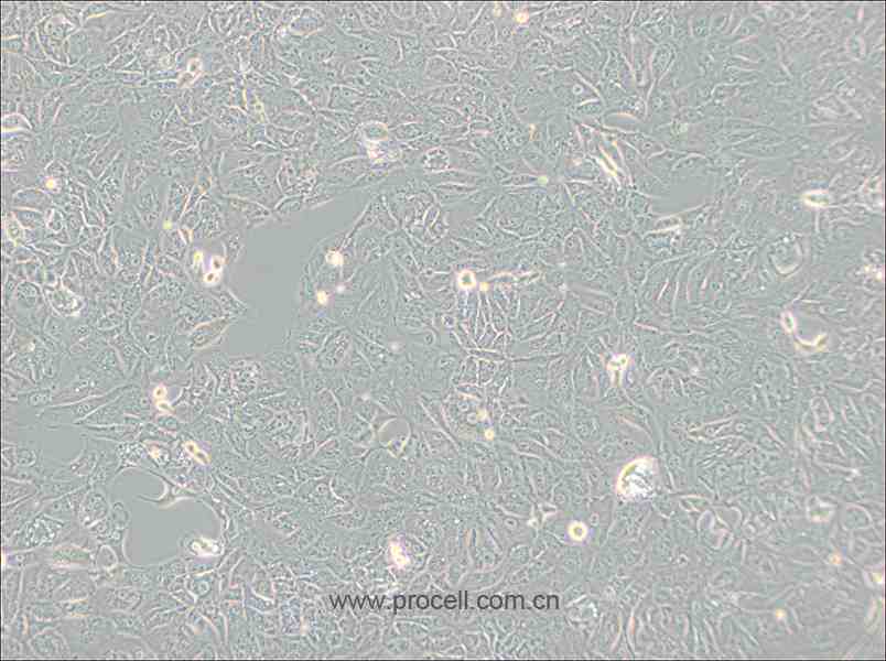 769-P (人腎細胞腺癌細胞) (STR鑒定正確)