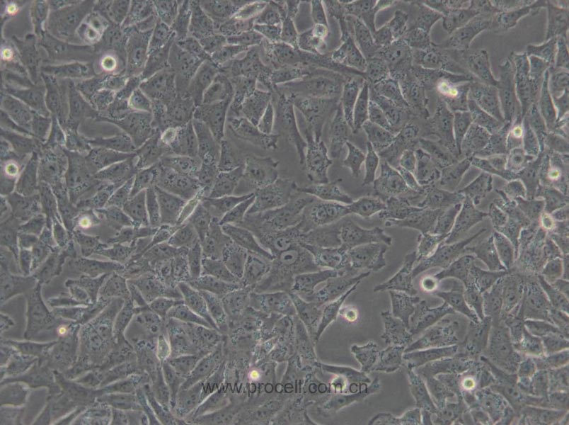 A-375 (人惡性黑色素瘤細(xì)胞) (STR鑒定正確)