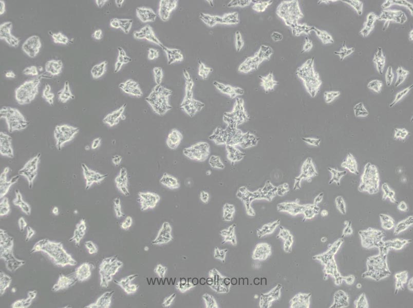 AR42J (大鼠胰腺外分泌細胞)(種屬鑒定正確)