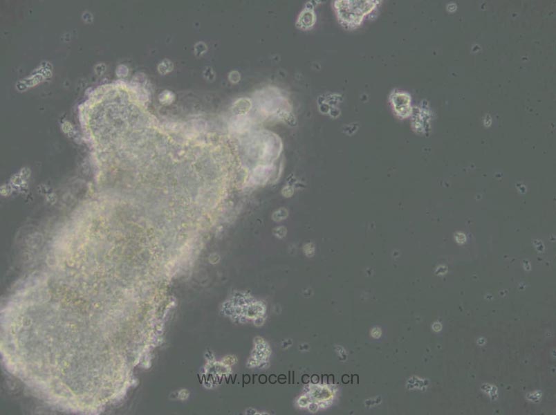 AtT-20 (小鼠垂體瘤細(xì)胞) (STR鑒定正確)
