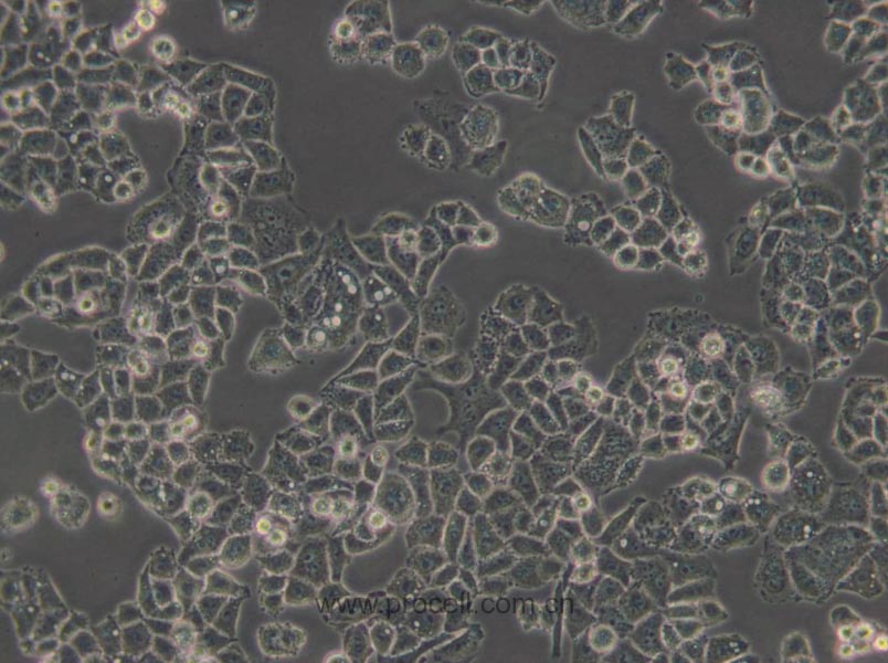C-33 A (人子宮頸癌細胞) (STR鑒定正確)