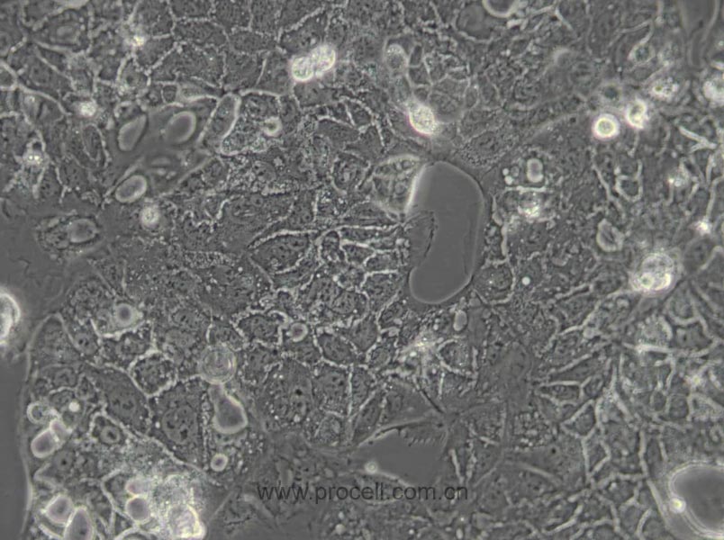Caco-2 (人結(jié)直腸腺癌細(xì)胞) (STR鑒定正確)
