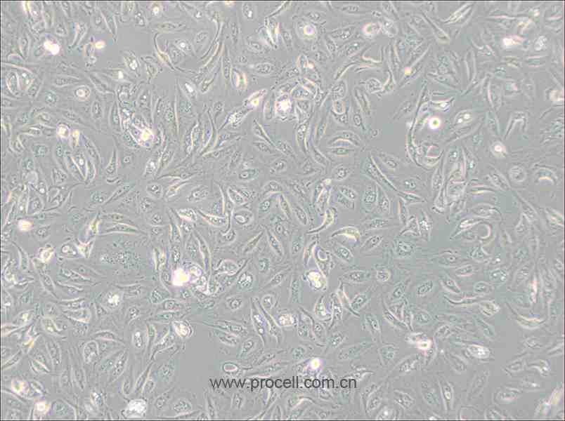 Caki-1 (人腎透明細胞癌皮膚轉移細胞) (STR鑒定正確)