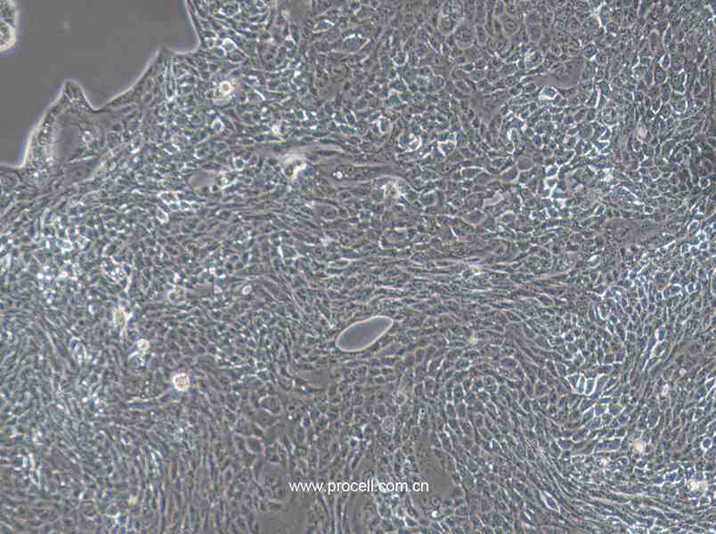 Calu-3 (人肺腺癌細(xì)胞(胸水)) (STR鑒定正確)