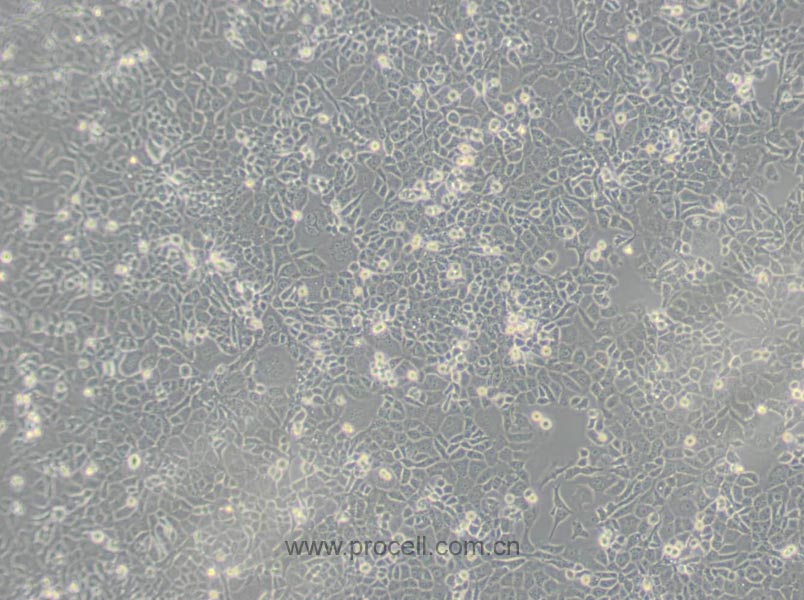 L2 (大鼠肺泡上皮細(xì)胞)(暫不出售）