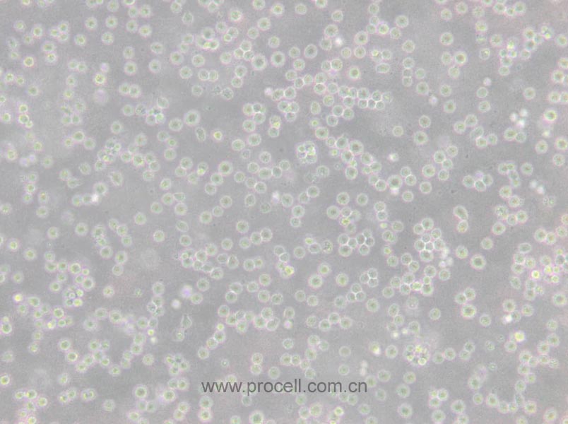 CCRF-CEM [CCRF CEM] (人急性淋巴細胞白血病T淋巴細胞) (STR鑒定正確)