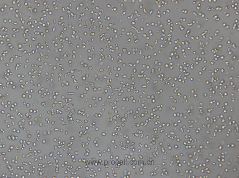 CoC1/DDP (人卵巢癌細胞CoC1順鉑耐藥亞株) (STR鑒定正確)