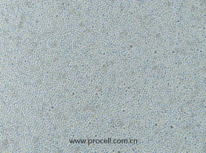 CoC1/DDP (人卵巢癌細(xì)胞CoC1順鉑耐藥亞株) (STR鑒定正確)