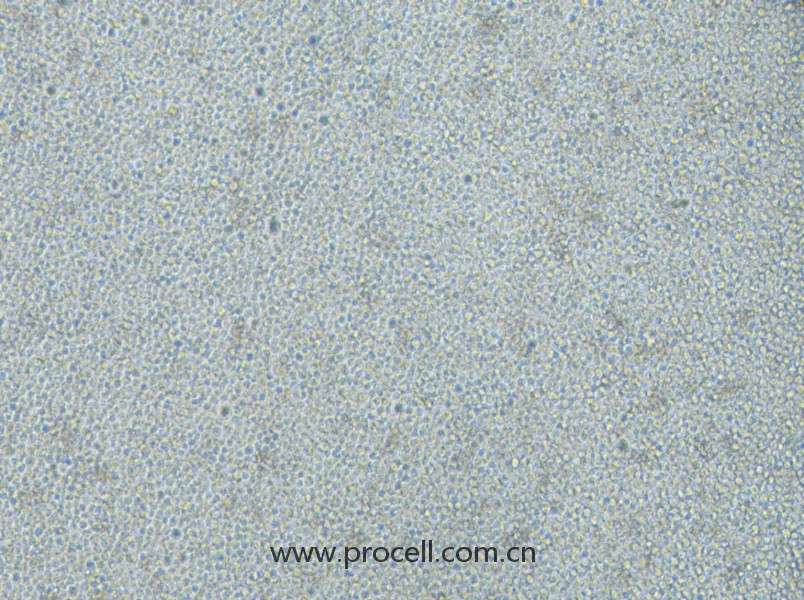 CoC1/DDP (人卵巢癌細(xì)胞CoC1順鉑耐藥亞株) (STR鑒定正確)