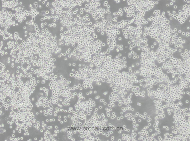 COLO 205 (人結(jié)腸癌細(xì)胞) (STR鑒定正確)