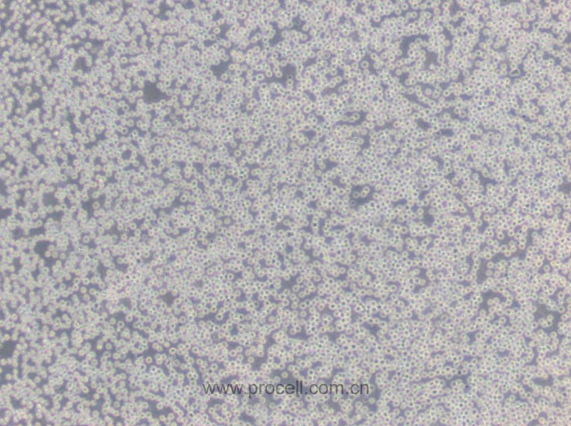 Daudi (人Burkitt's淋巴瘤細(xì)胞) (STR鑒定正確)