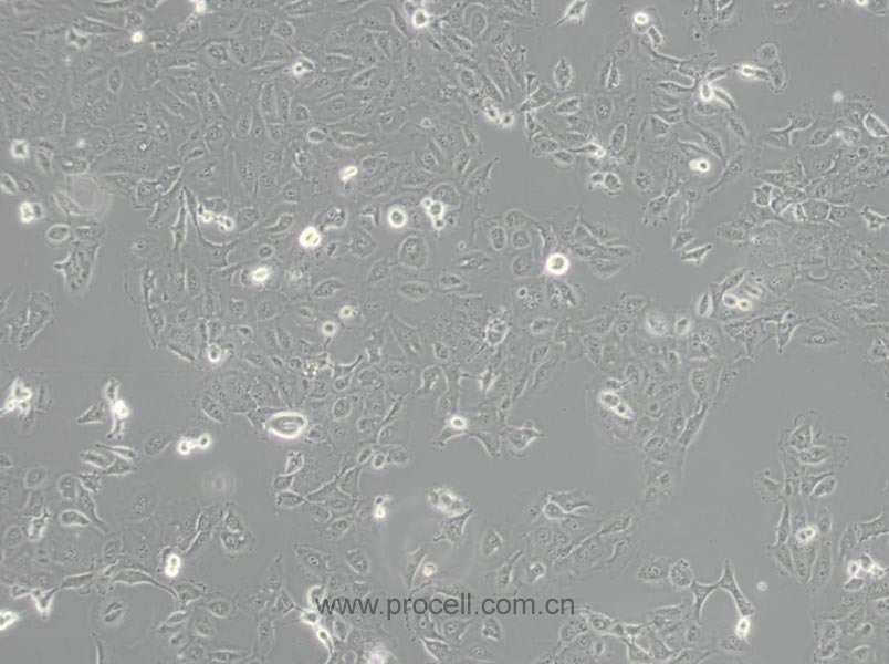 DU 145 (人前列腺癌細胞) (STR鑒定正確)