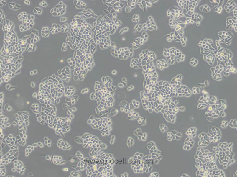 Eca-109 (人食管癌細(xì)胞) (Hela污染細(xì)胞系，暫不供應(yīng))