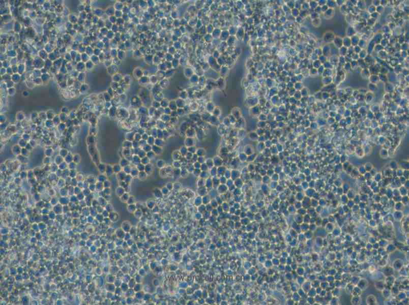 F9 (小鼠畸胎瘤細胞/小鼠胚胎癌細胞) (STR鑒定正確)