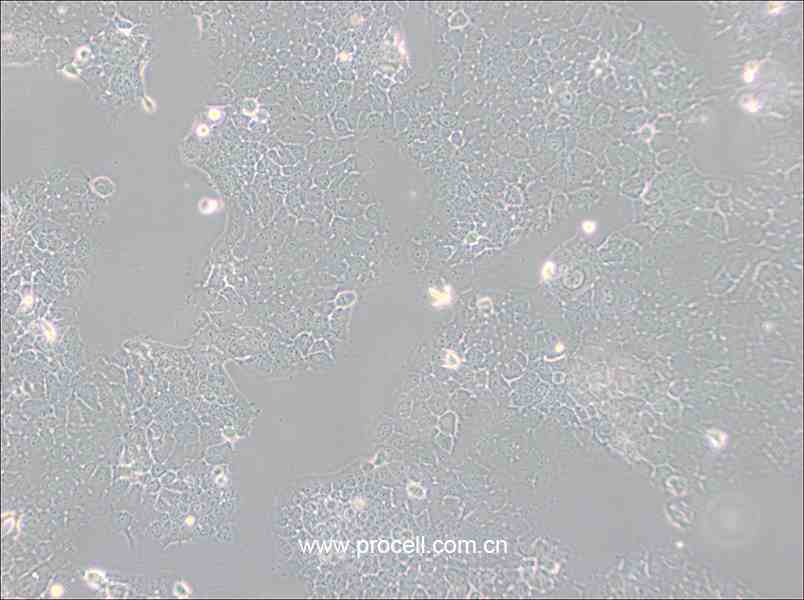 FaDu (人咽鱗癌細胞) (STR鑒定正確)