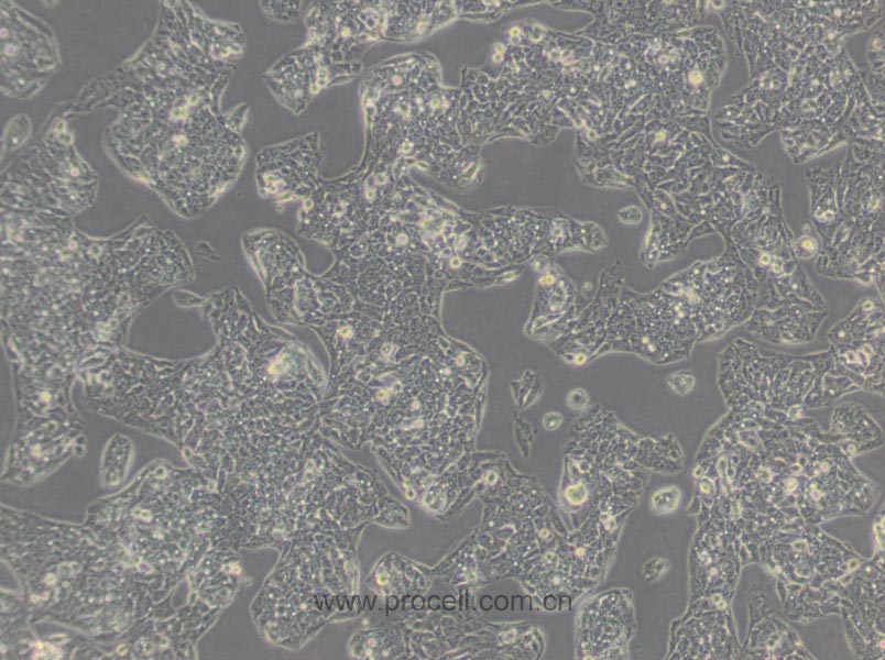 Hep G2 (人肝癌細胞) (STR鑒定正確)