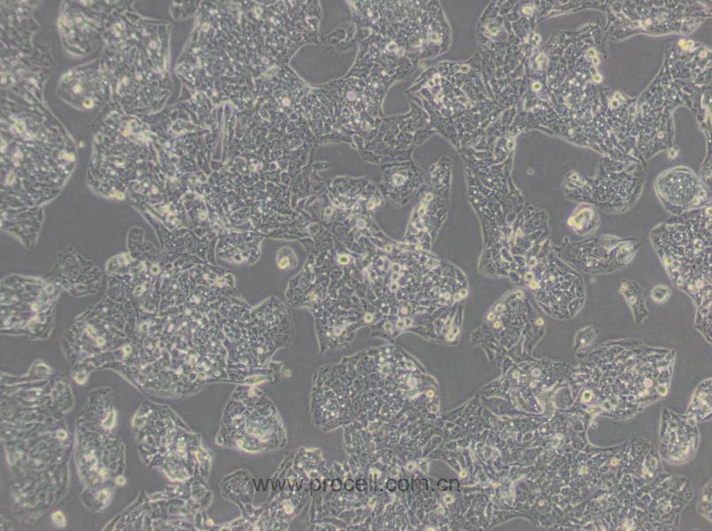 Hep G2 (人肝癌細胞) (STR鑒定正確)