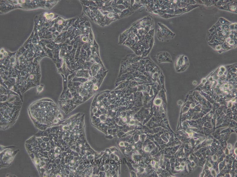 Hep G2 (人肝癌細胞) (STR鑒定正確)