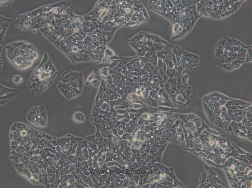 Hep G2 (人肝癌細胞) (STR鑒定正確)