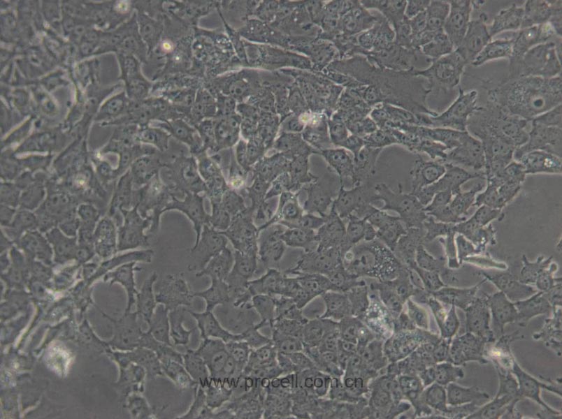 Hepa 1-6 (小鼠肝癌細(xì)胞) (STR鑒定正確)
