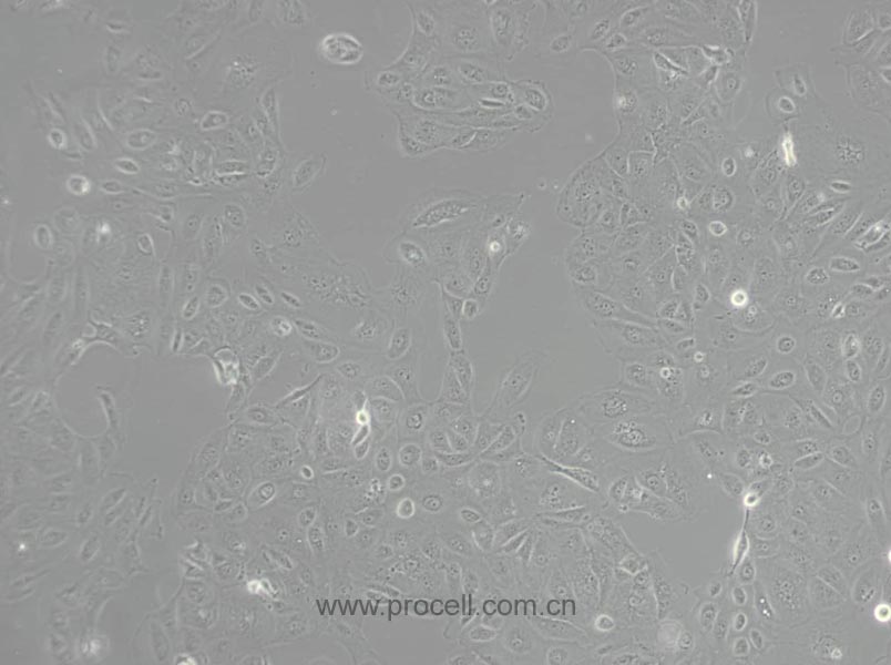 HK-2 (人腎皮質(zhì)近曲小管上皮細(xì)胞) (STR鑒定正確)