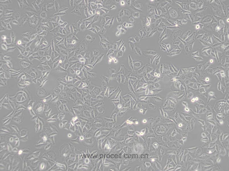 HL-7702 [L-02; LO2] (人正常肝細(xì)胞) (Hela污染細(xì)胞系，暫不供應(yīng))