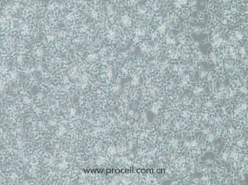 IMR-32 (人神經(jīng)母細(xì)胞瘤細(xì)胞) (STR鑒定正確)