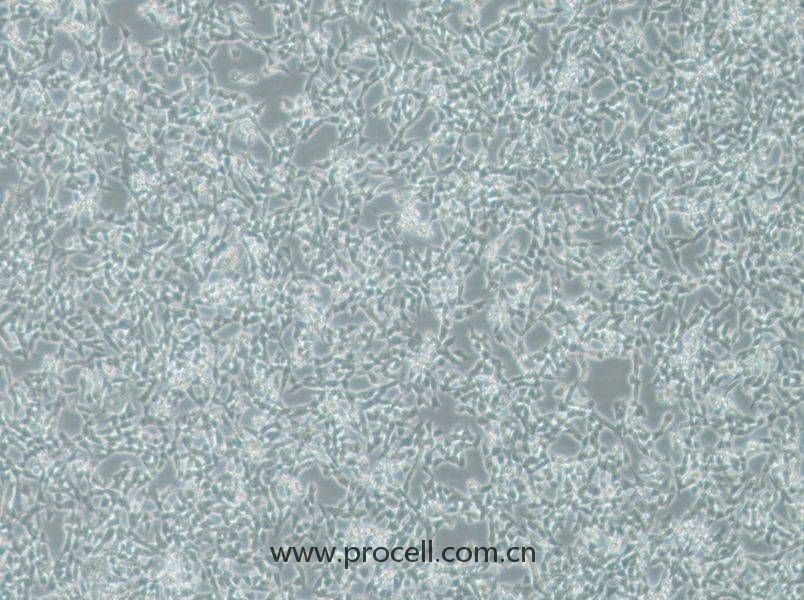 IMR-32 (人神經(jīng)母細(xì)胞瘤細(xì)胞) (STR鑒定正確)