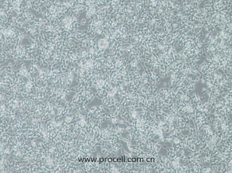 IMR-32 (人神經(jīng)母細(xì)胞瘤細(xì)胞) (STR鑒定正確)