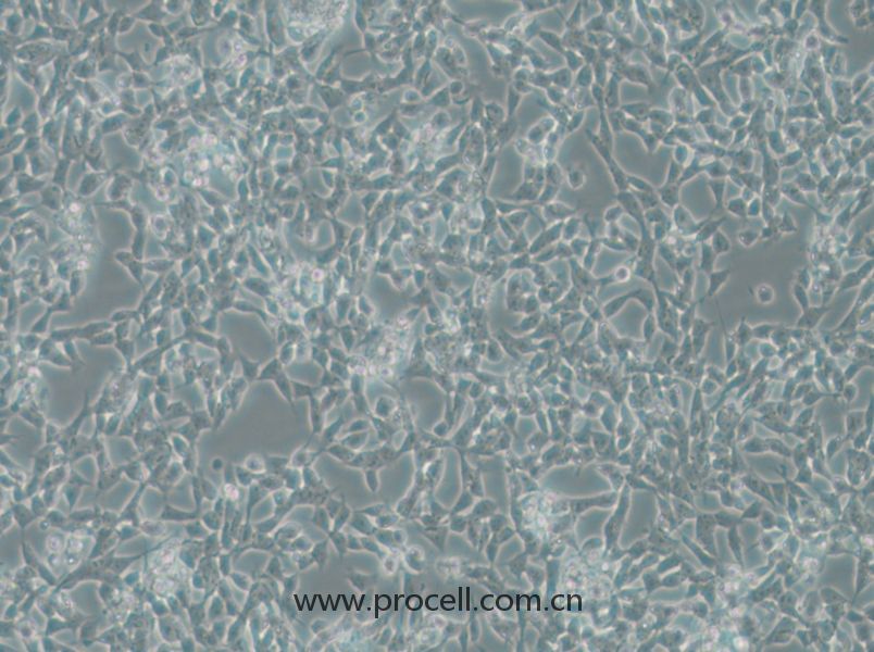 IMR-32 (人神經(jīng)母細(xì)胞瘤細(xì)胞) (STR鑒定正確)