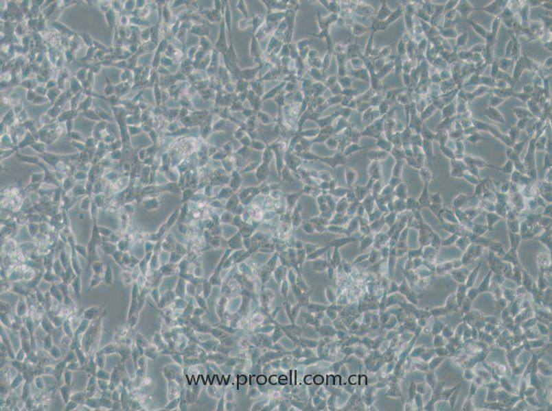 IMR-32 (人神經(jīng)母細(xì)胞瘤細(xì)胞) (STR鑒定正確)