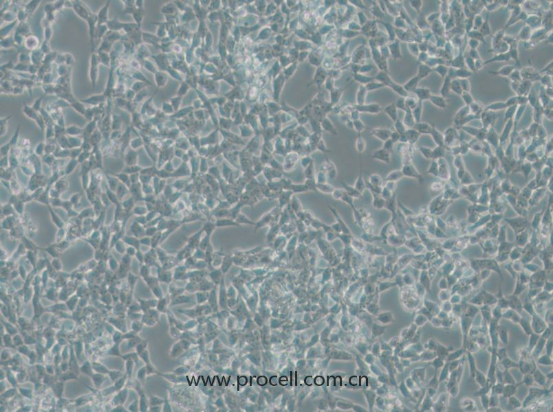 IMR-32 (人神經(jīng)母細(xì)胞瘤細(xì)胞) (STR鑒定正確)