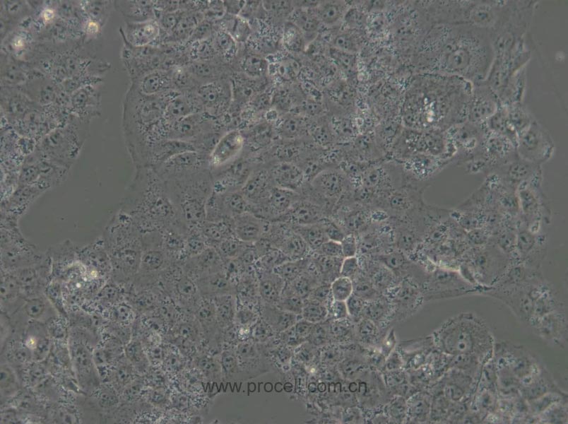 JAR (人胎盤絨毛癌細(xì)胞) (STR鑒定正確)