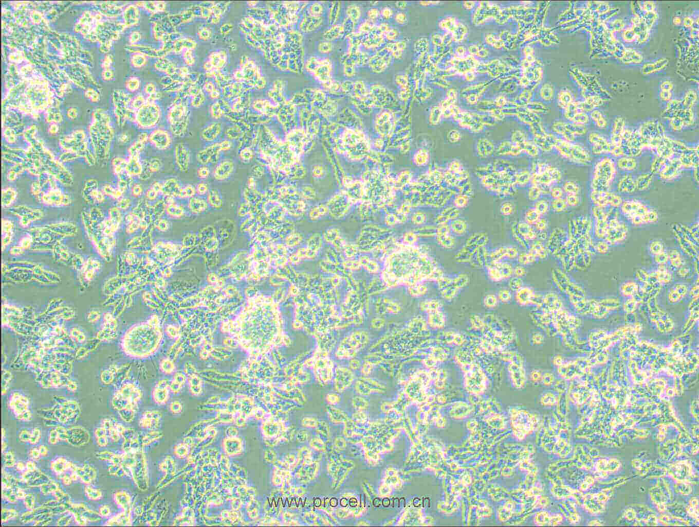 LLC [LL/2; LLC1] (小鼠肺癌細胞) (STR鑒定正確)