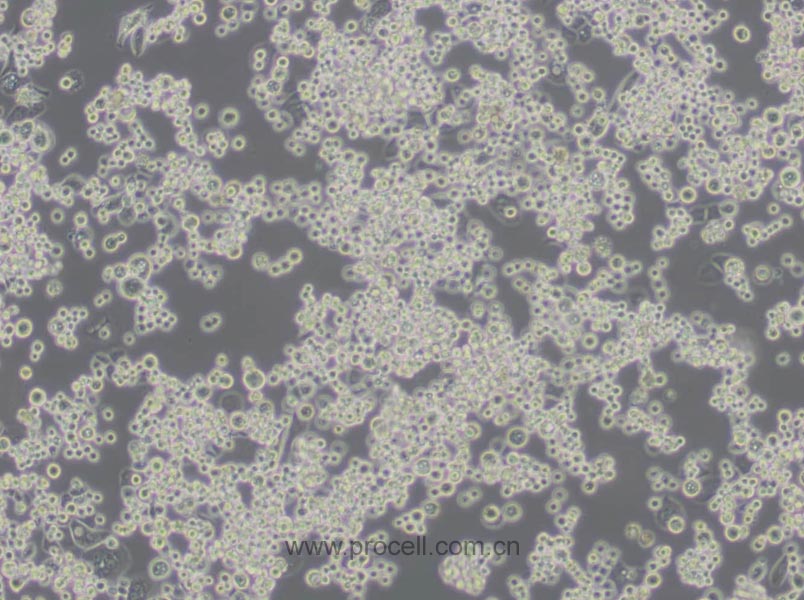 MDA-MB-453 (人乳腺癌細(xì)胞) (STR鑒定正確)