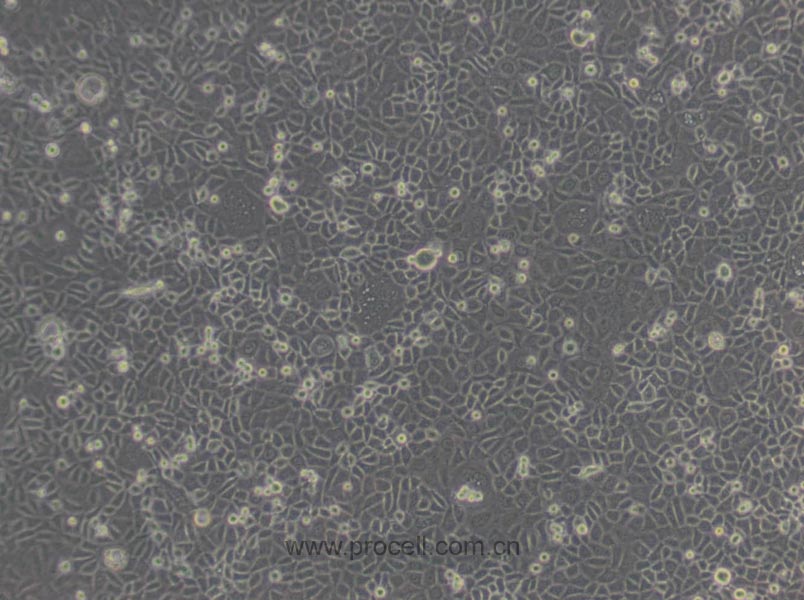 ME-180 (人子宮頸表皮癌細(xì)胞) (STR鑒定正確)