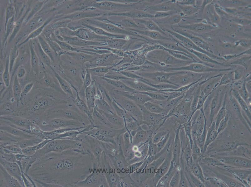 MS1 (小鼠胰島內(nèi)皮細(xì)胞) (STR鑒定正確)