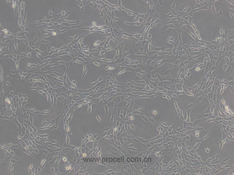 NIH/3T3 (小鼠胚胎細(xì)胞) (STR鑒定正確)