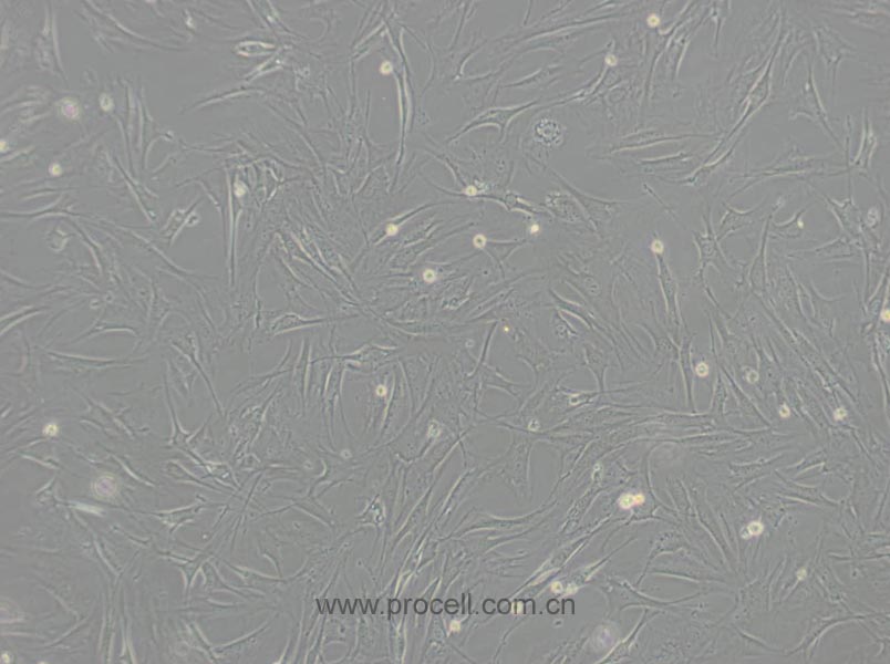 OP9 (小鼠骨髓基質(zhì)細胞) (STR鑒定正確)