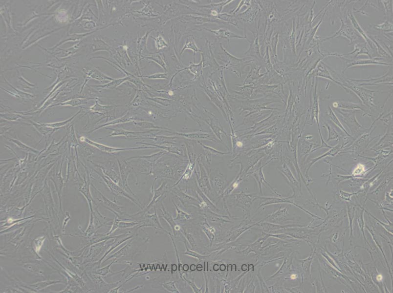 OP9 (小鼠骨髓基質(zhì)細胞) (STR鑒定正確)