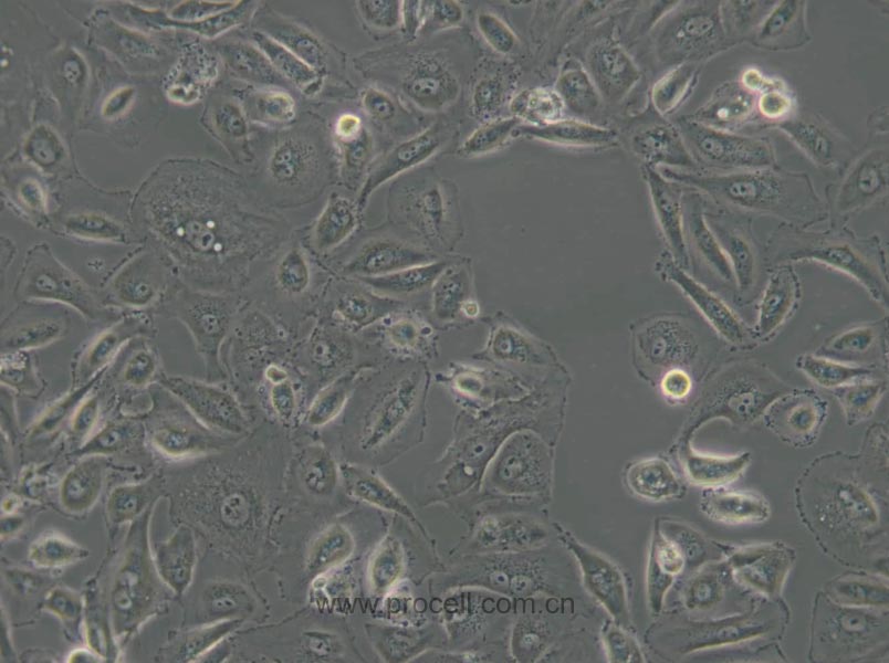 OS-RC-2 (人腎癌細(xì)胞) (STR鑒定正確)