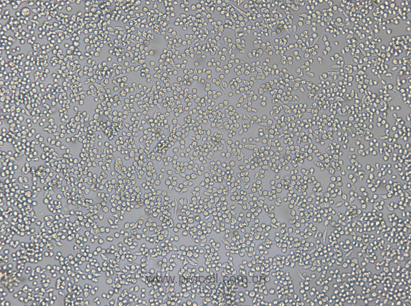 P815 (小鼠肥大細(xì)胞瘤細(xì)胞) (種屬鑒定正確)